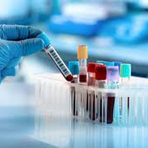 Procurement of Supply, Delivery, Installation and Commission of Laboratory Equipment for the Malawi Bureau of Standards (MBS), Ministry of Agriculture Departments of Agriculture and Research Services (DARS) and Department of Animal Health and Livestock Development (DALHD).